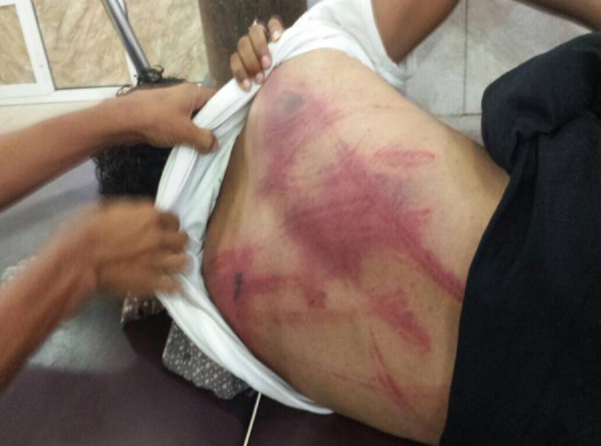 Student from Taiz subjected to torture by Aden’s security belt members